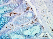 IHC staining of HSP90 in inflammatory cells in mouse colon tissue