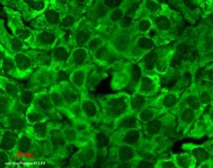 Hsp90 visualized in human keratinocyte line HaCat using Anti-HSP90 Antibody