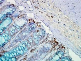 IHC staining of inflammatory cells and epithelia mucosa in mouse colon tissues, using Anti-Hsp90 (clone: AC-16)