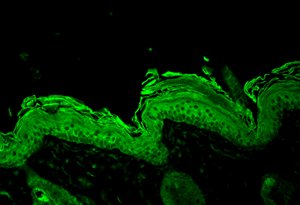 Hsp90 visualized on Bouin’s fixed paraffin embedded backskin sections of transgenic mice, using Anti-Hsp90 Antibody